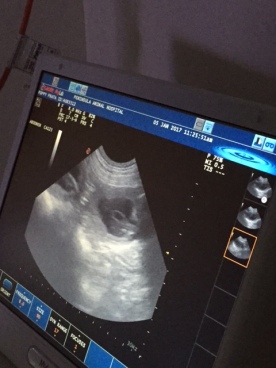 ultrasound1