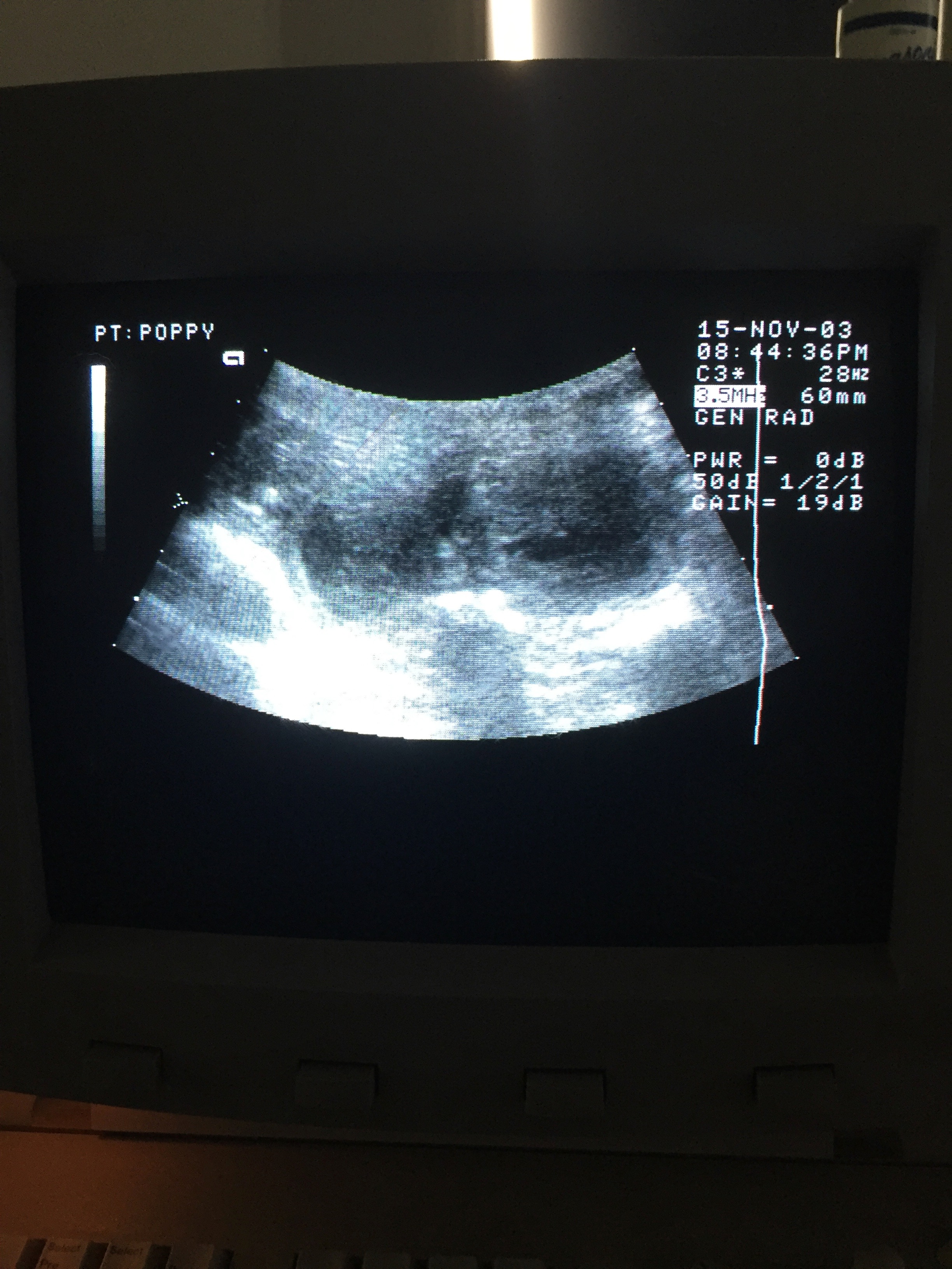 Ultrasound 19 Dec 2018